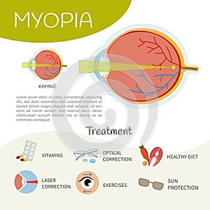 Infografica eyes disease