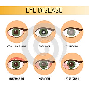 Infographic eyes disease