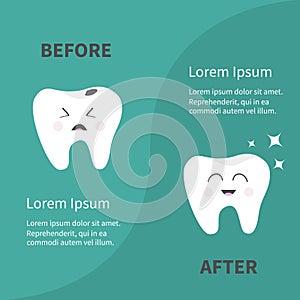 Before after Infographic Healthy smiling tooth icon. Shining star. Crying bad ill teeth with caries. Template with text. Cute char