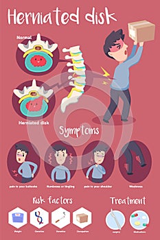 Infographic Herniated disk