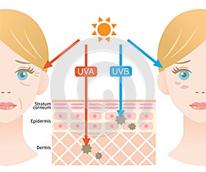 Infographic illustration of difference between UVA and UVB rays.  UV penetration into human skin and white woman face. skin care