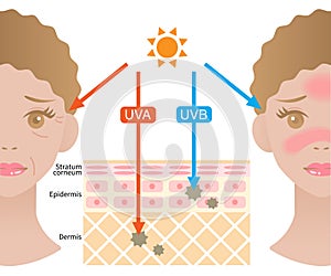 Infographic illustration of difference between UVA and UVB rays.  UV penetration into human skin and woman face. skin care and