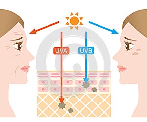 Infographic illustration of difference between UVA and UVB rays. UV penetration into human skin and woman face. skin care and beau