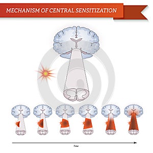 Infographic mechanism of central sensitization. photo