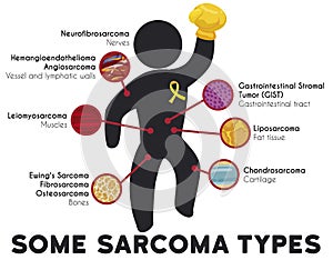 Infographic Showing Some Sarcoma Types and Principal Affected Tissues, Vector Illustration photo