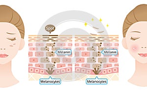 Infographic skin cell turnover illustration. Melanin and melanocytes in human skin layer with woman face. beauty and skin care con photo