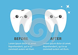 Before after Infographic Template. Tooth icon set. Shining star. Healthy smiling Crying bad ill teeth with caries. Cute cartoon