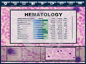 Infographic of a ui screen with medical report from Hematology laboratory. Illustration of user interface with results of blood photo