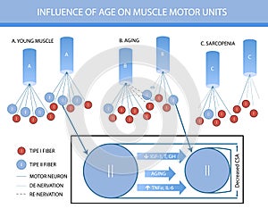 Infographics: in fluence of age on muscle motor units photo