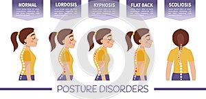 Infographics of posture disorders. photo