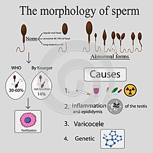 Infographics sperm morphology