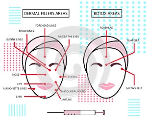 Infograthic poster about dermal fillers and botox ares. Injections. Cosmetology. Beauty. Vector Illustration.