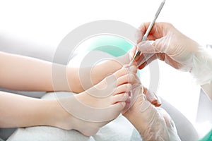 Ingrown toenail. The surgeon cuts his toenail photo