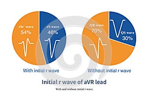 Initial r wave of aVR lead photo