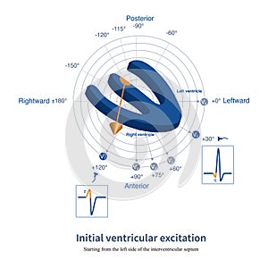 Initial ventricular excitation
