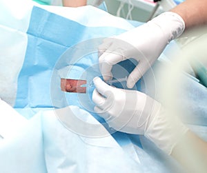 Injection in a sterile environment