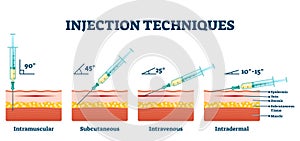 Injection techniques vector illustration. Medical procedure examples scheme