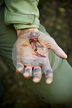 Injured Injury Hand Cut Blood