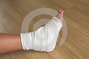 Injured male leg, cruciform bandage on the ankle joint.