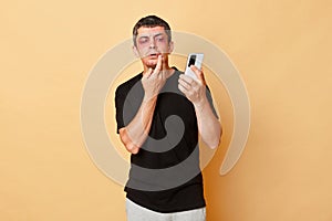 Injured man in black T-shirt with bruises and abrasions on his face isolated over beige background looking at smartphone camera to