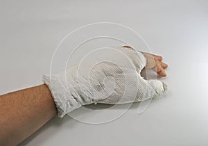 Injured person with the broken limb after the car accident
