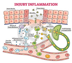 Injury inflammation as body response process in educational outline diagram
