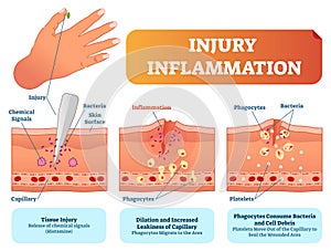 Infortunio infiammazione biologico Uomo corpo la risposta vettore illustrazioni sistema. pelle superficie infortunio attraverso sezione manifesto 