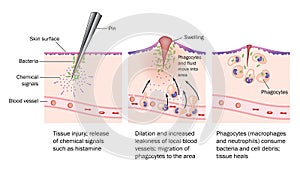 Injury and inflammation photo