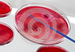 INOCULATION MICROBIOLOGY