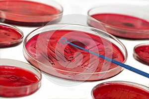 INOCULATION MICROBIOLOGY