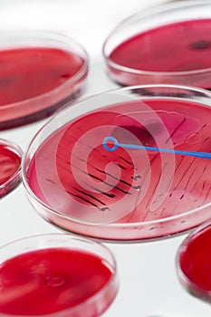 INOCULATION MICROBIOLOGY