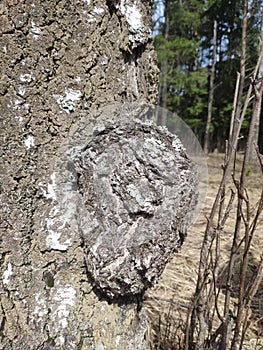 Inonotus obliquus, chaga, birch mushroom on a tree trunk in the forest. antitumor and gastritis agent