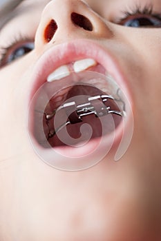 Inside view of orthodontics photo