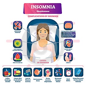 Insomnia vector illustration. labeled sleeplessness symptoms, causes scheme photo