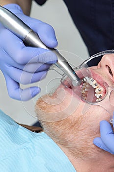 The installation of braces. Correction of malocclusion or dentition. A young man at an orthodontist`s appointment. Hands in