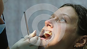 Installation and fixation of the metal bracket system. Visit to the dentist orthodontist, correction of malocclusion