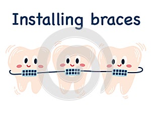 Installing braces.