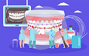 Installing dental braces vector illustration with dentists mini people with huge mouth orthodontic cocept.