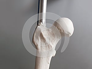 Instrument and plastic bone for orthopedic surgeries training