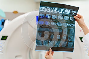 Instrumental research diagostic methods of computer tomography. X-ray picture in hands. CT on background.