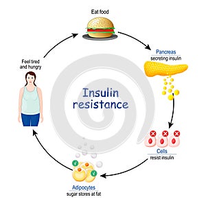 Insulin Resistance. cycle of insulin and glucose photo