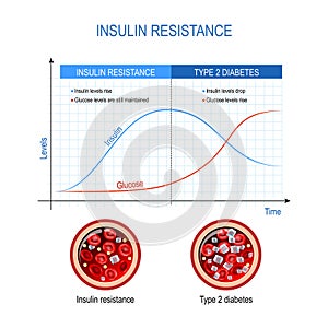 Insulin resistance and Type 2 diabetes