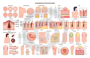 Integumentary system pathologies set. Skin, glands, hair and nail disorders photo