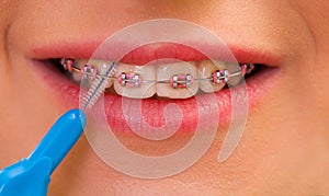 Interdental brushing