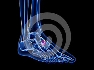 The intermediate cuneiform bone