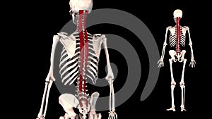 Intermediate postvertebral muscle -real color - 3D model