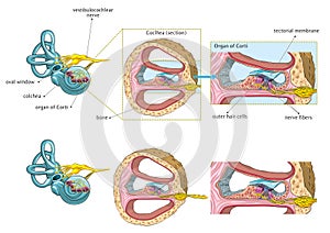 Internal ear