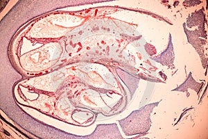 Internal ear, Foetal under the microscope in Lab.