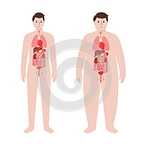 Orgány v obézní člověk tělo 