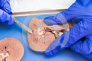 Internal structure of a sheep kidney